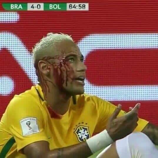 brasil-golea-pero-neymar-sale-lesionado