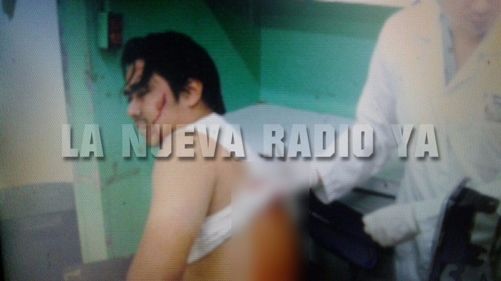 Alexander José Maltes Gómez mientras es atendido tras ser lesionado