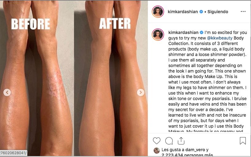 De esta forma Kim Kardashian oculta las marcas de la psoriasis con su maquillaje. Fuente Instagram
