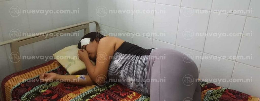 Fanny Rubenia Ruiz Centeno deberá ser sometida a varias cirugías tras haber sido mordida por una joven ebria en Estelí